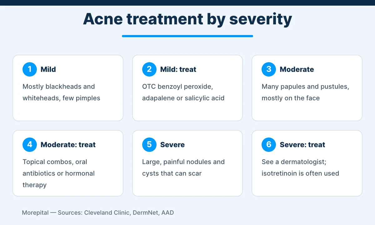 Acne treatment by severity: mild, moderate and severe acne and matching treatments