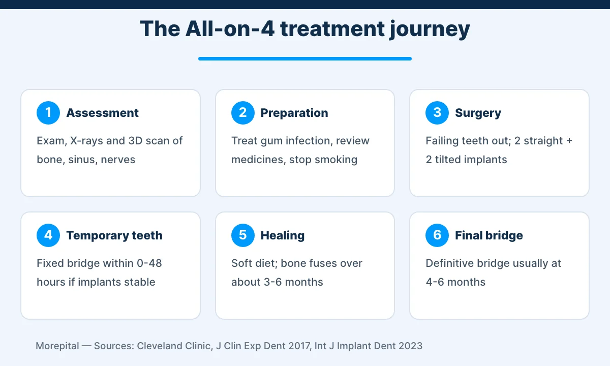 All-on-4 dental implants infographic showing six treatment stages from assessment to the final bridge