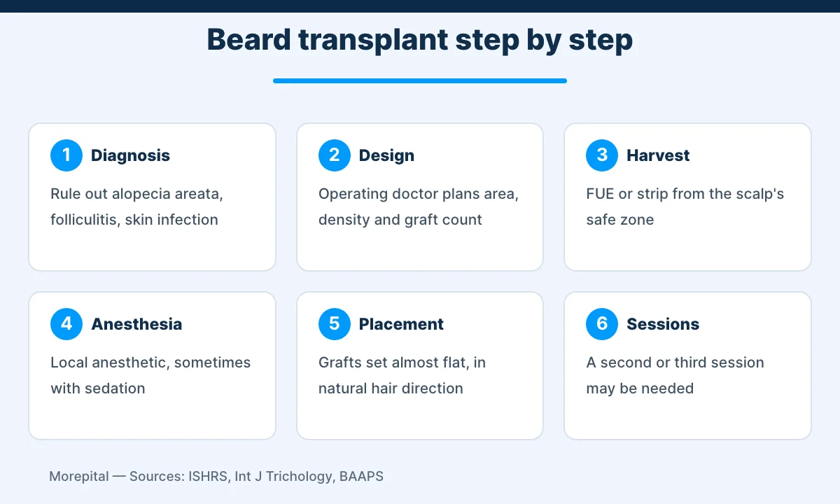 Beard transplant in Turkey procedure steps infographic