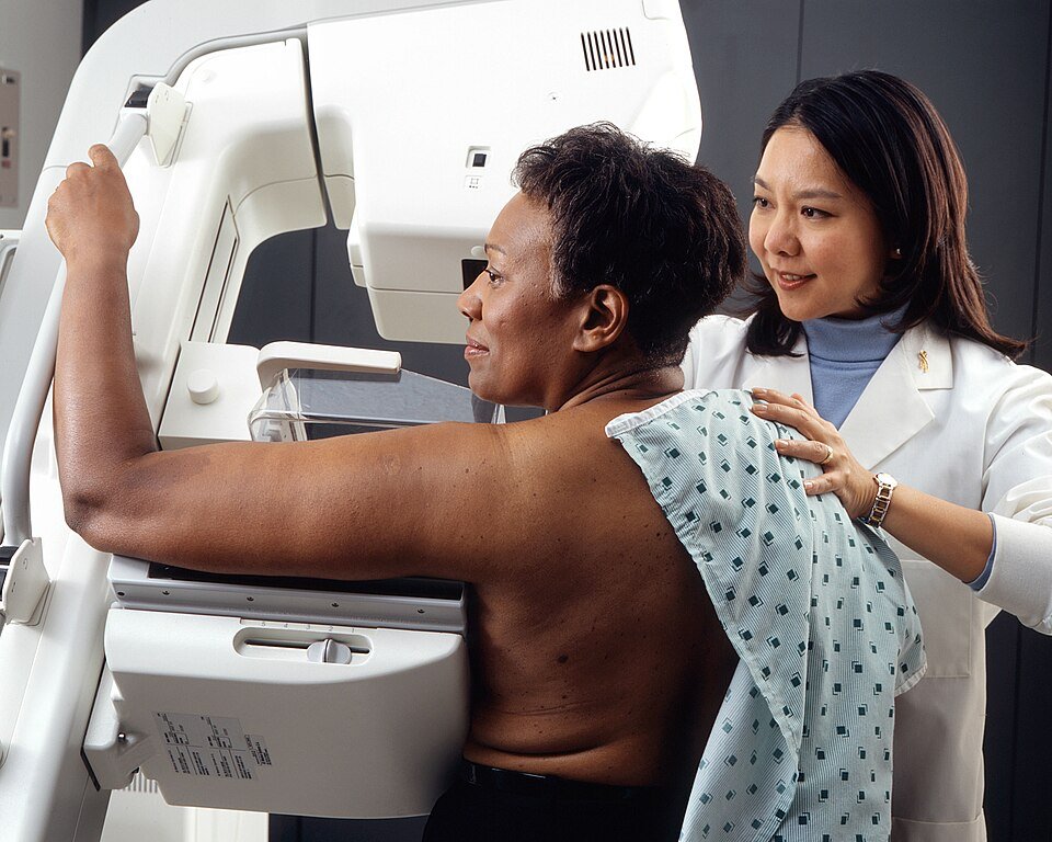 A woman having a mammogram, the main imaging test used to check breast cancer symptoms