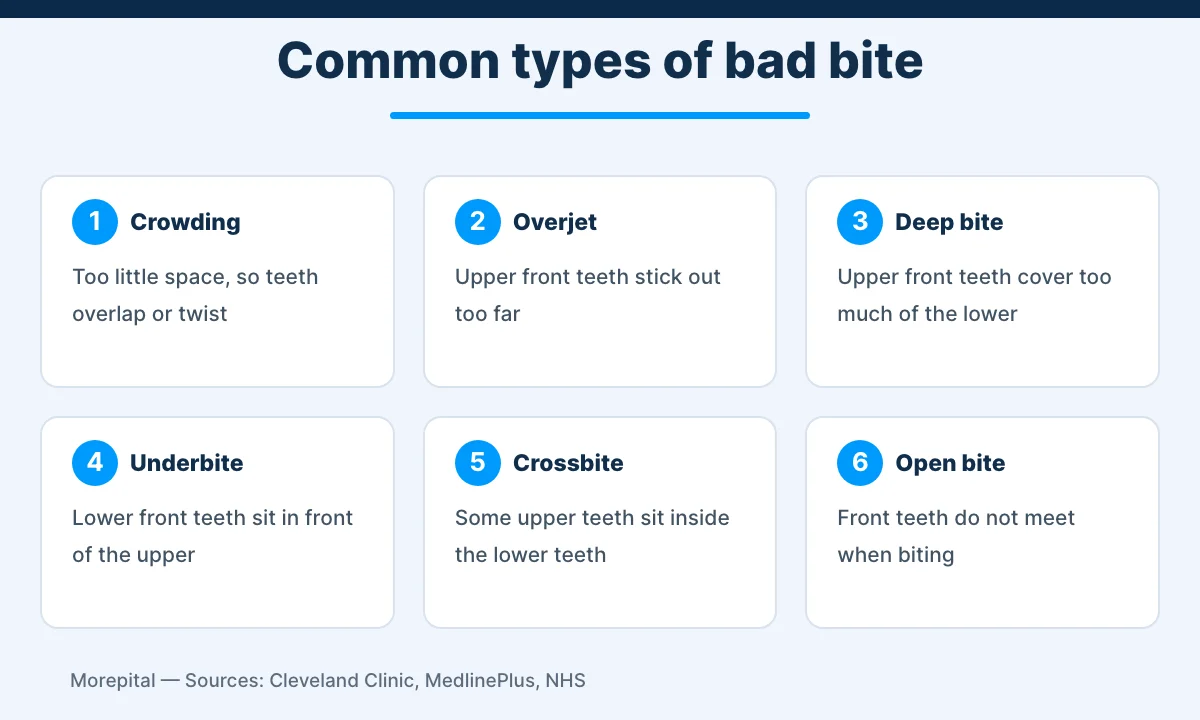 Infographic showing six common types of malocclusion: crowding, overjet, deep bite, underbite, crossbite and open bite
