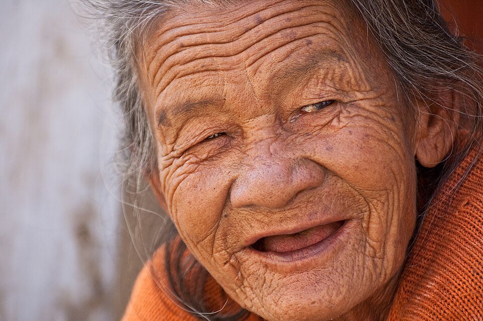 Close-up of an older woman's face showing wrinkles and loose, sagging skin on the cheeks and jaw
