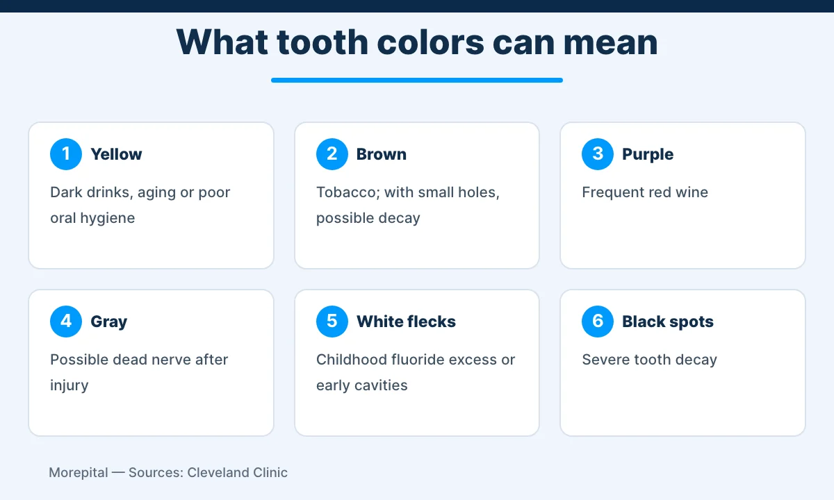 Infographic of tooth discoloration colors and their likely causes: yellow, brown, purple, gray, white flecks and black spots