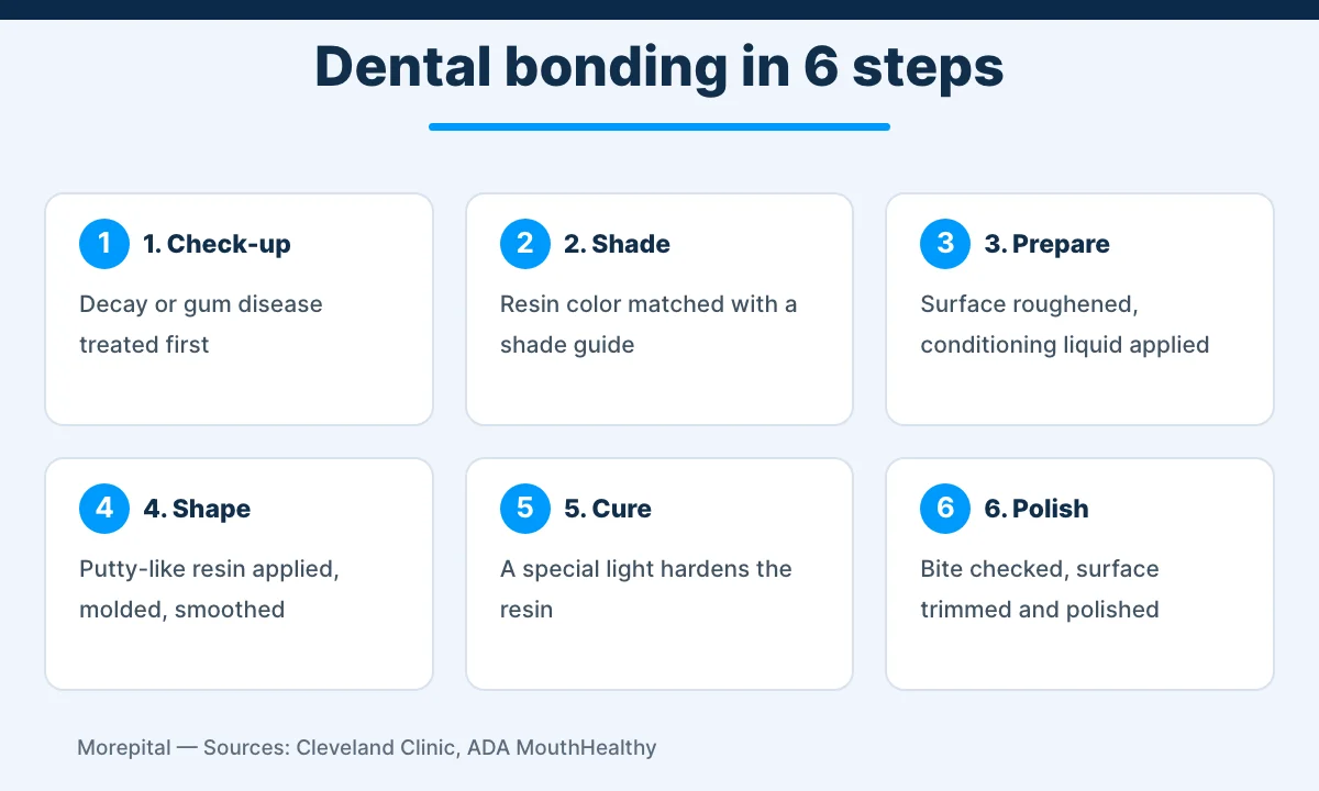 Dental bonding infographic showing the six steps of the procedure