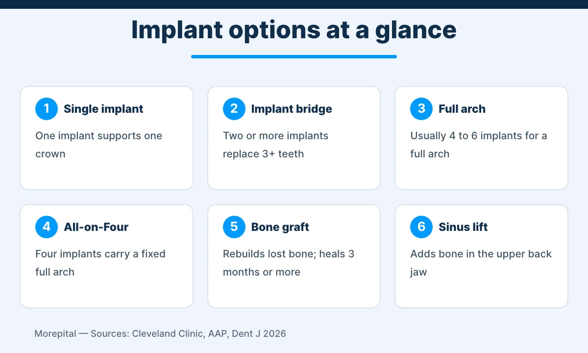 Dental implants in Turkey infographic showing single, bridge, full-arch and bone graft options