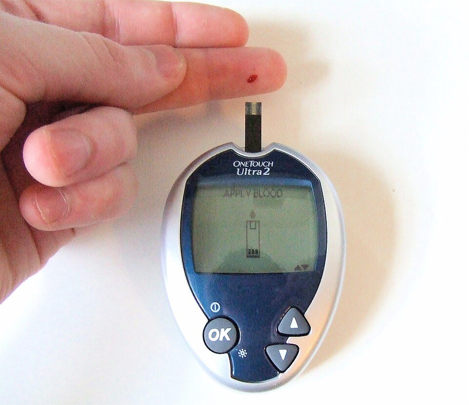Finger-prick blood glucose test used to check diabetes symptoms