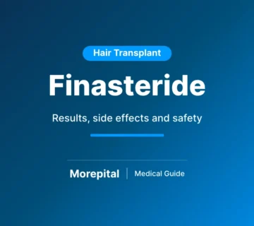 Finasteride for hair loss