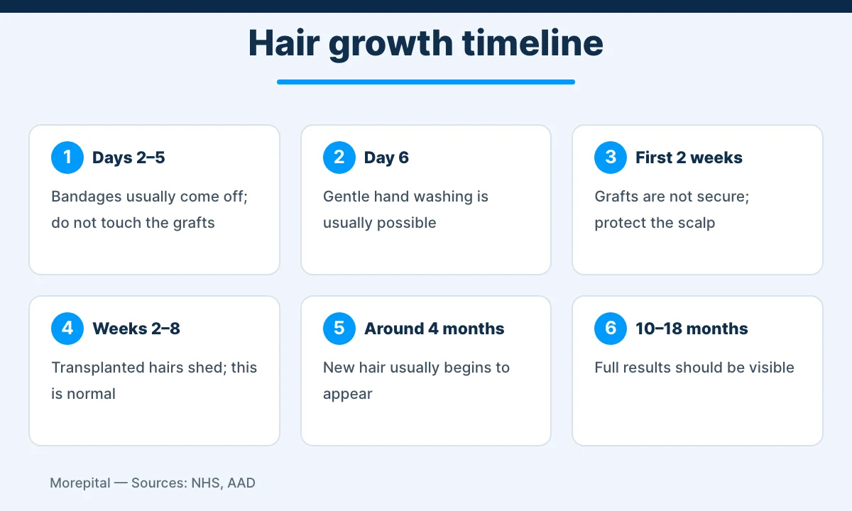 Hair transplant in Turkey recovery and hair growth timeline infographic