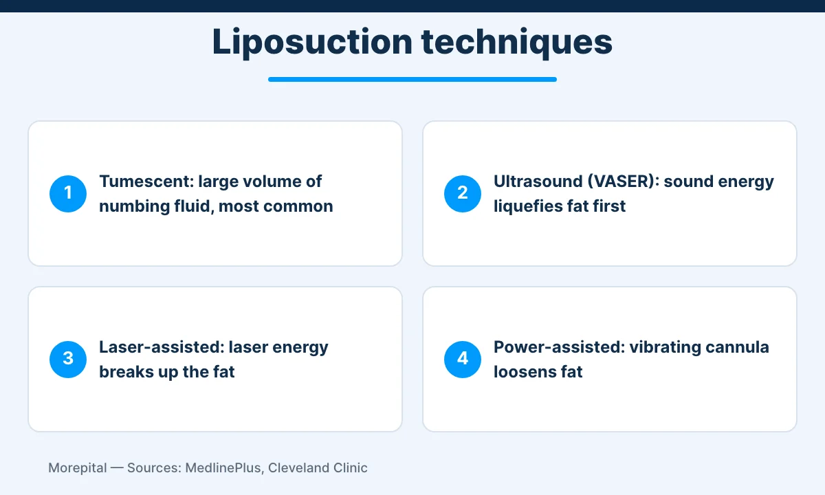 Liposuction in Turkey infographic comparing tumescent, ultrasound, laser and power-assisted techniques