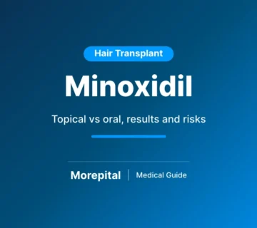 Minoxidil for hair loss