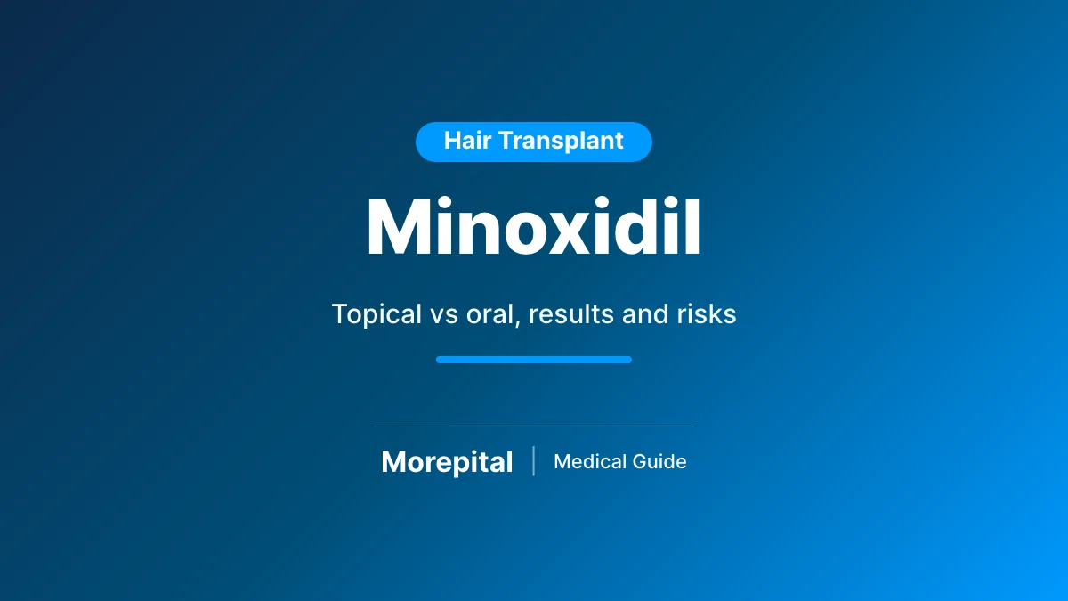 Minoxidil for hair loss