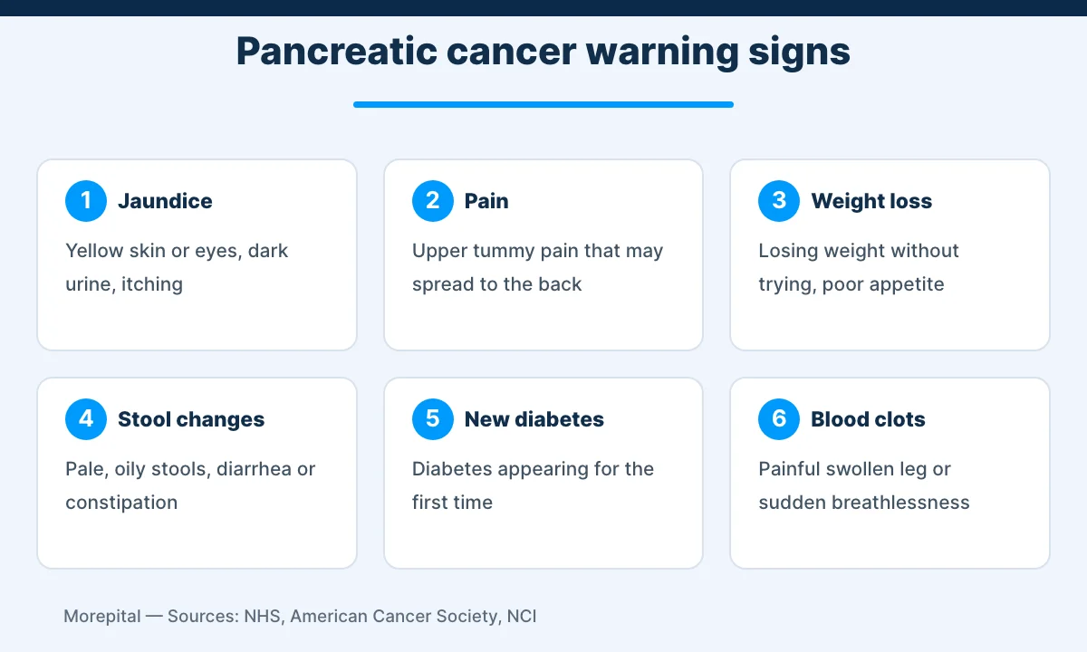 Infographic of six pancreatic cancer symptoms, from jaundice and back pain to new diabetes and blood clots