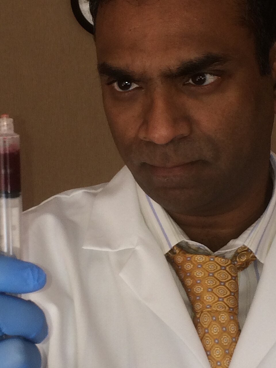 Platelet-rich plasma in a syringe ready for a PRP hair treatment injection