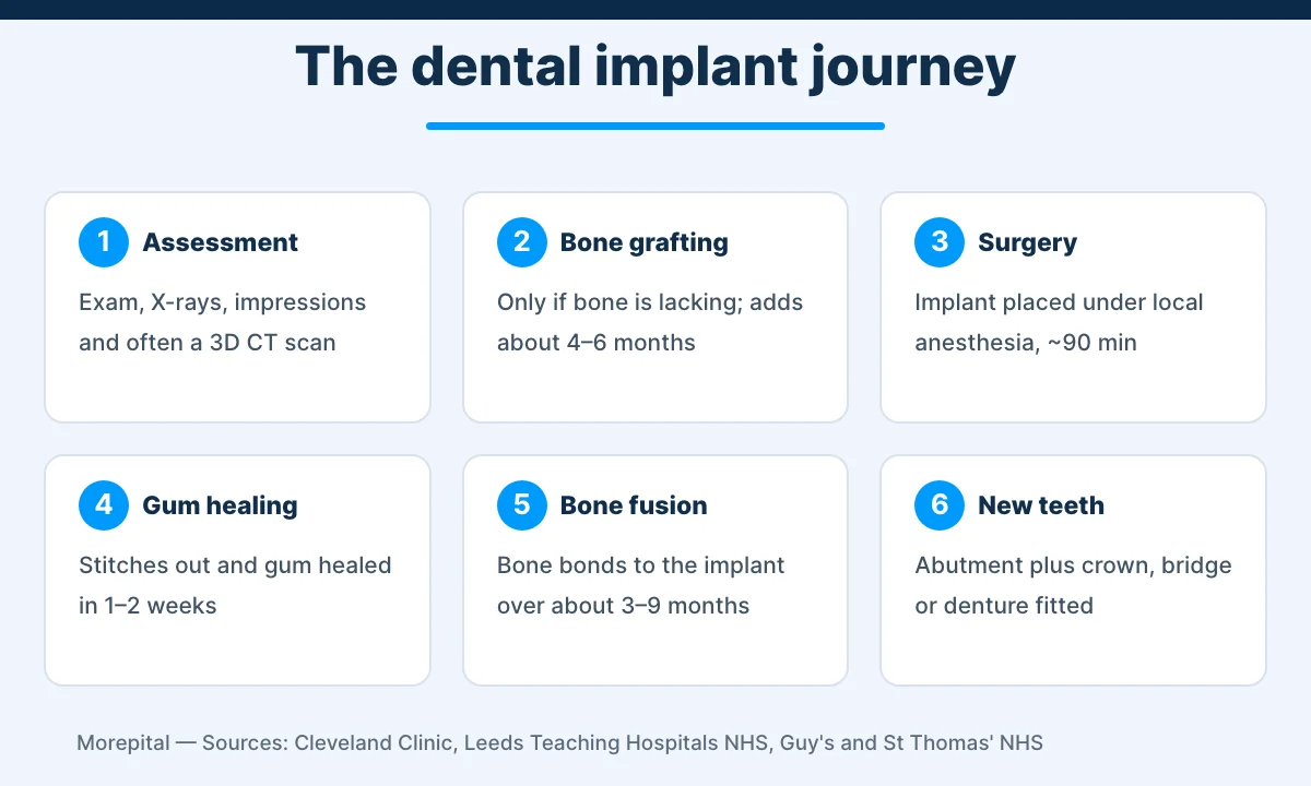Six-step infographic of dental implant treatment from assessment to fitting new teeth