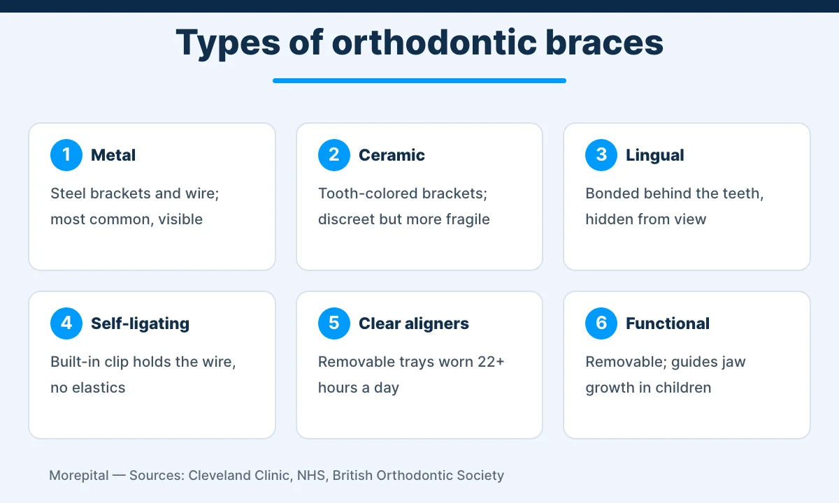 Infographic comparing six types of orthodontic braces: metal, ceramic, lingual, self-ligating, clear aligners and functional appliances