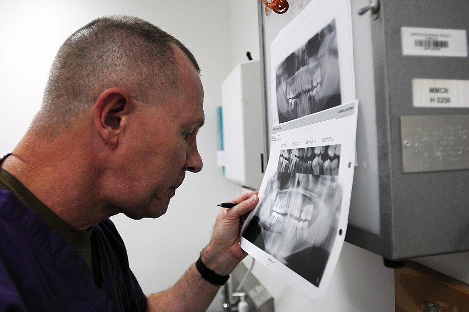 Toothache diagnosis: a dentist examines a patient's dental X-rays