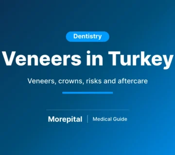 Veneers in Turkey