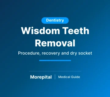 Wisdom teeth removal