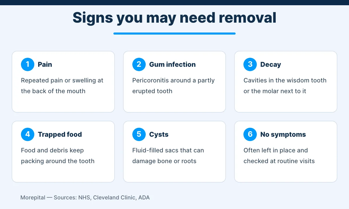 Signs that wisdom teeth removal may be needed: pain, gum infection, decay, trapped food and cysts