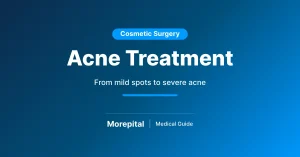 Acne treatment