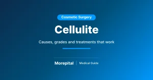 Cellulite