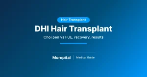 DHI hair transplant