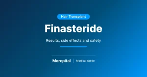 Finasteride for hair loss