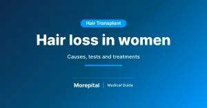 Hair loss in women