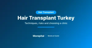 Hair transplant in Turkey