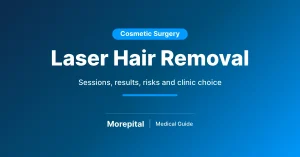 Laser hair removal