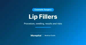 Lip fillers