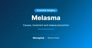 Melasma
