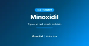 Minoxidil for hair loss