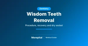 Wisdom teeth removal